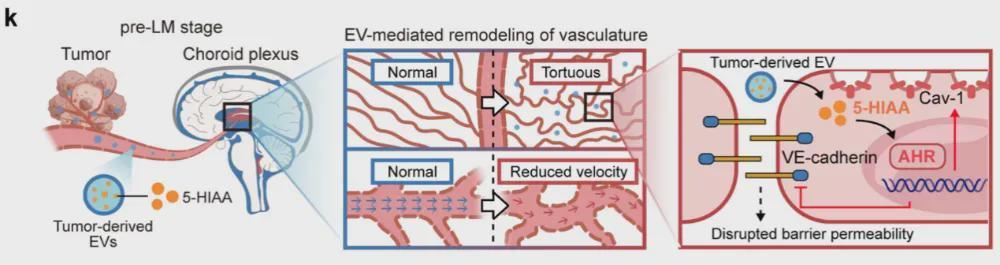  【技术深挖】软脑膜转移机制：5-HIAA如何瓦解血脑脊液屏障 健康养生